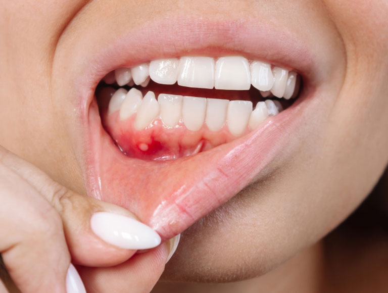 Is Gum Disease Treatment Right for You?
